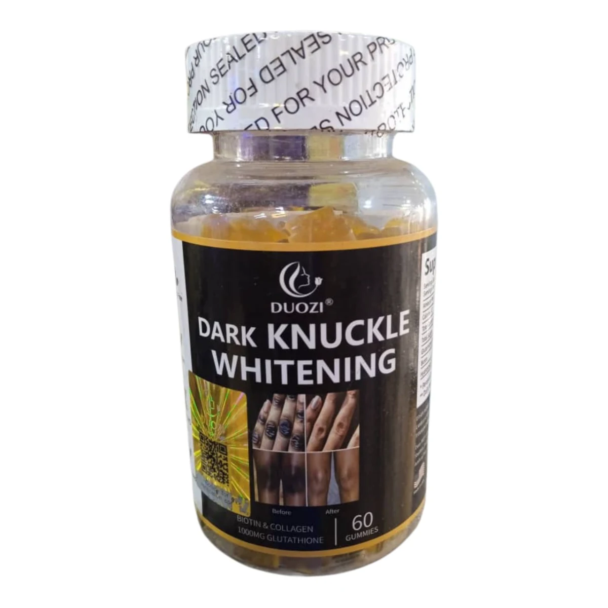 Dark knuckle whitening